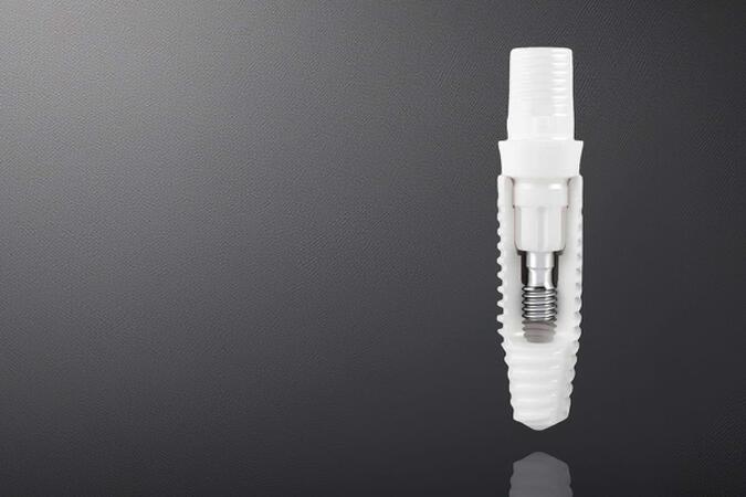 Keramikimplantat statt Titan